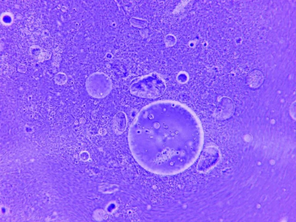 Imagem de microscopia em tons de violeta mostrando estruturas celulares circulares e microrganismos sobre fundo texturizado.